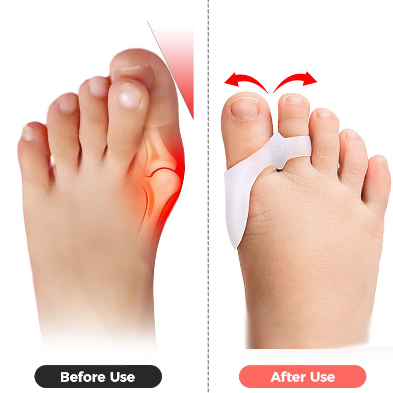 Pexmen 2/4Pcs Toe Spacers Buni - Power Tools Kids ulasan dan harga